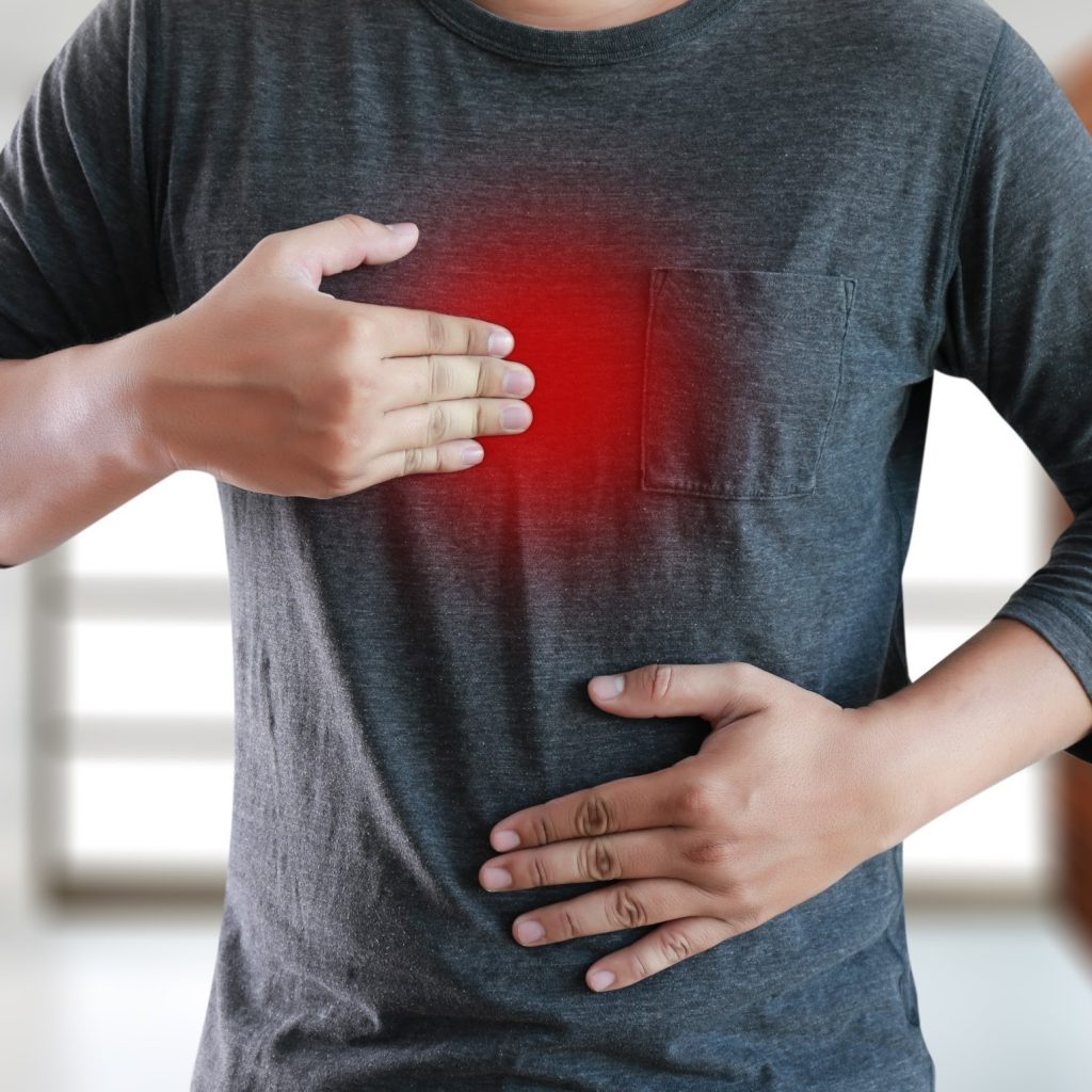 What Are Ways To Manage Acid Reflux?