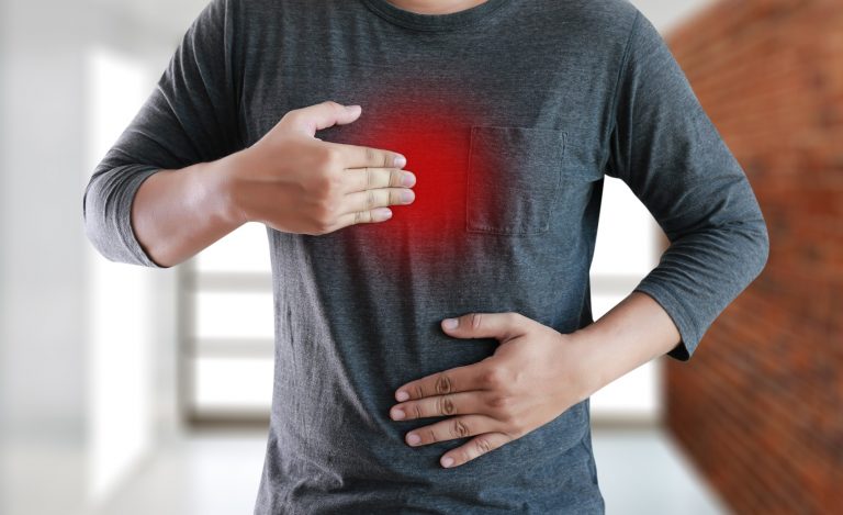 What Are Ways To Manage Acid Reflux?