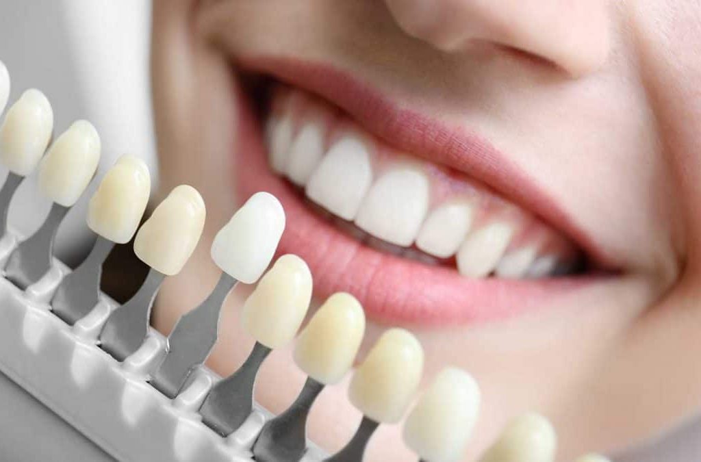 4 Essential Benefits of Cosmetic Dentistry in Sydney