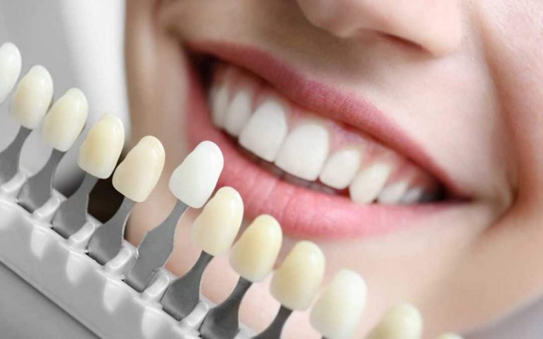 4 Essential Benefits of Cosmetic Dentistry in Sydney