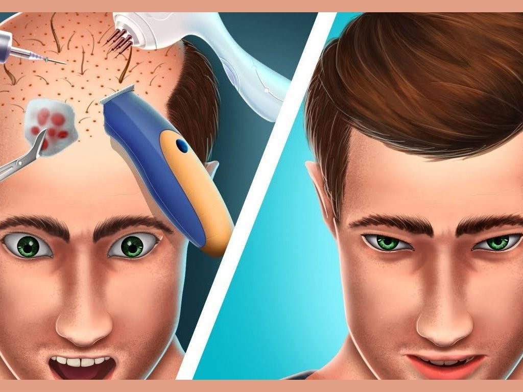 Cost for Different Hair Transplant Technique Cost for Different Hair Transplant Technique