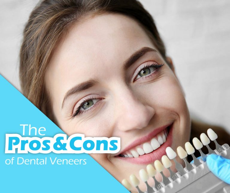 Pros and Cons of Dental Veneers